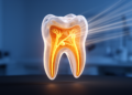 Hidden Fourth Canal Found in Nearly Half of Children's Baby Molars, 3D Scans Reveal