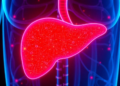 A Tiny Dose of Radiation Could Stop Cancer From Spreading to the Liver