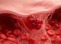 Blood Clotting Abnormalities Linked to Poorer IVF Outcomes in Endometriosis