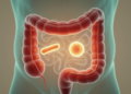 Dual-Origin Probiotic Blend Eases Gut Inflammation in Rat Colitis Model