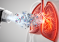 Single-Inhaler Triple Therapy and Biologics Reshape COPD Treatment, Review Finds
