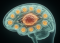 Potassium channel gene KCNJ11 predicts glioma survival and chemotherapy response