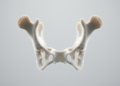 Hyoid bone CT analysis estimates sex with 93.8 percent accuracy in forensic study