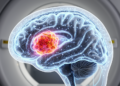 AI Brain Tumor MRI Models Hit 96.8% Accuracy, but Transparency Lags