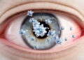 Dual-Drug Nanovesicle Gel Cuts Eye Pressure in Rabbits, Offering a New Glaucoma Strategy