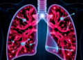 BALF Metagenomic Sequencing Maps Lower-Airway Microbial Shifts in Tuberculosis