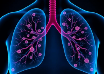 How Lung Cancer Rewires Fat Metabolism to Grow, Spread, and Evade Treatment