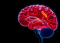 Gut Microbiome Signature Emerges in Adults with Chronic Subdural Hematoma