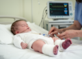 Infant cobalamin C deficiency linked to severe vascular complications