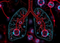 Clusterin shields lung cells from sepsis damage by blocking Bax-driven mitochondrial injury