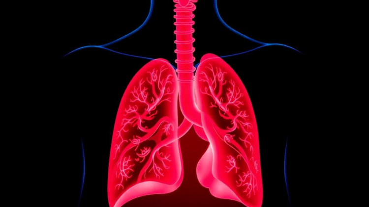 Quantitative PCR Outperforms Microscopy in Turkish Study of Pneumocystis Pneumonia