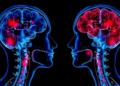 Spinal Fluid Inflammatory Proteins Reveal Why ALS Progresses at Different Speeds