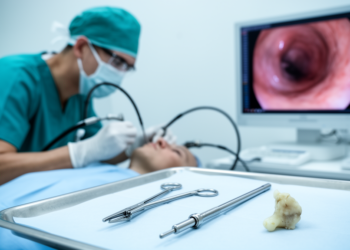 Research report: Broncholith Removal Using a Cryoprobe in Combination With Biopsy Forceps in a Patient With Immune Thrombocytopenia: A Case Report