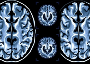 Brain Scans Reveal When Alzheimer's Damage First Appears in Younger Patients