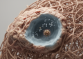 Senescent Lung Fibroblasts in Pulmonary Fibrosis Mount a Broken Antiviral Response