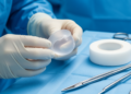 Polyethylene Eye Chamber Faces Adhesive Tape in Brazilian Pilot Trial Protocol for Surgical Corneal Protection