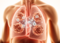 Checkpoint inhibitors linked to longer unadjusted progression-free survival in advanced thoracic tumors