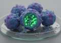 HDAC Inhibitor Plus Cisplatin Stabilizes Advanced Adenoid Cystic Carcinoma