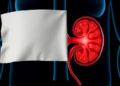 Kidney Cancer Paper Retracted After Editors Flag Overlapping Figures