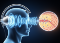 Holographic ultrasound opens the blood-brain barrier to deliver stroke therapies