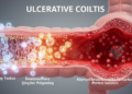 Review links protein modifications to ulcerative colitis mechanisms