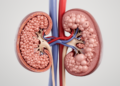 Review: Kidney fat compartments show distinct biology and treatment-linked remodeling