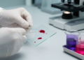 Simple Stain Choice Shifts Avian Blood Cell Counts and Stress Ratios
