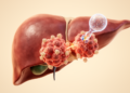 Checkpoint inhibitors improve survival in pMMR metastatic colorectal cancer meta-analysis