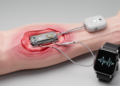 Body tissue links miniature implants to wearable health devices
