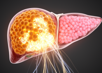 SP1-induced PDRG1 drives hepatocellular carcinoma growth via Wnt/β-catenin signaling