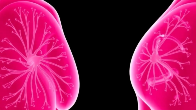 Root Canal Bacteria and Breast Cancer: New Meta-Analysis Finds No Clear Link, But Clues to Tumor Progression