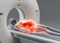 MRI reveals two concurrent surgical emergencies in late pregnancy