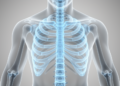 Modeling Shows AI Chest X-Ray Osteoporosis Screening Cost-Effective