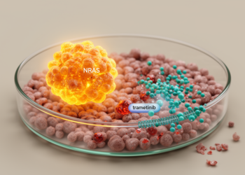 NRAS mutation renders ovarian cancer cells vulnerable to MEK inhibitor trametinib