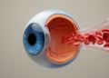 Hematocrit shows no independent link to diabetic retinopathy in cross-sectional study