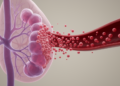 Lobular metastatic breast cancer sheds far more circulating tumor cells than ductal
