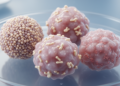 HER2 patterns vary across ovarian cancer subtypes