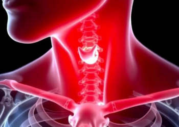 Hidden Cancers in Overactive Thyroids: Study Finds One in Three Graves' Patients Harbored Tumors