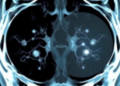 AI Reads Thyroid Nodules Like a Radiologist, Zone by Zone