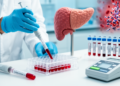 Blood proteins linked to prostate cancer risk over decade before diagnosis