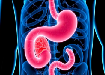 Pancreatic Cancer Is Being Caught Earlier Than Ever, Landmark 20-Year Analysis Finds