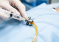 Antimicrobial locks show early control of cancer catheter infections