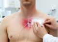Clinical review addresses recurrent infections with long-term catheters