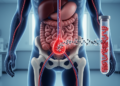 Blood DNA biomarkers track progression during prostate cancer radioligand therapy