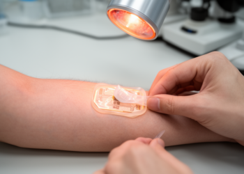 Shape-memory patch enables low-force skin-device detachment