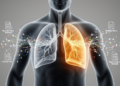Interpretable machine learning model stratifies latent tuberculosis risk using low-cost data