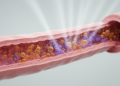 Chemotherapy and radiotherapy reshape evolution in healthy oesophagus tissue