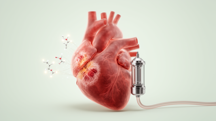 MicroRNA Scars of Heart Failure Persist After LVAD Support in Ischemic Cardiomyopathy