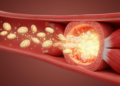 Platelet-guided gene therapy reprograms heart metabolism to promote repair in male mice