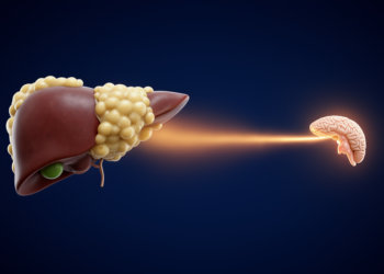 Fatty liver disease blunts the overnight rise of thyroid-stimulating hormone